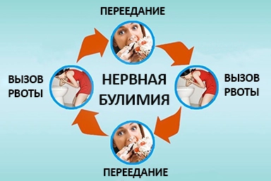 Лечение булимии в Мытищах